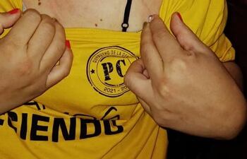 La licenciada Teresa Medina exhibió foto de que también fue víctima de agresión