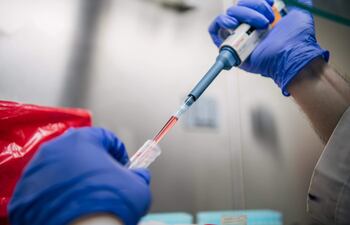 El técnico de laboratorio Julio Vásquez aísla muestras de COVID-19 en el laboratorio de diagnóstico Genview el 13 de agosto de 2021 en Houston, Texas. En toda el área metropolitana de Houston, las pruebas han aumentado significativamente a medida que la variante Delta abruma a los hospitales y las escuelas y las empresas continúan reabriendo.