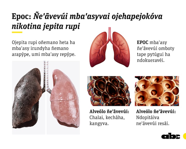 Ilustración referencial sobre conceptos de EPOC del libro Tesâirâ, Guaraní Médico, del profesor Carlos Ferreira.
