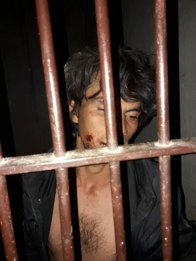 /pf/resources/images/abc-placeholder.png?d=2443