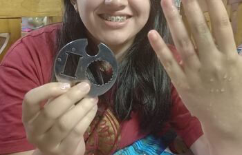 Inédito: bomberos lograron sacar un metal del dedo de una joven