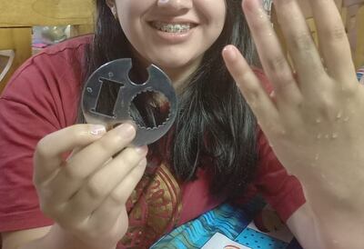 Inédito: bomberos lograron sacar un metal del dedo de una joven