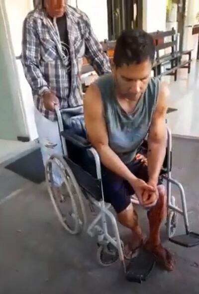 Jorge Duré Barboza resultó herido en el atentado.