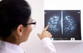 Una doctora observaun examen de rayos X en el recién inaugurado Centro de Atención Integral a la Mujer en la ciudad de Caacupé (Paraguay). Autoridades de Paraguay, con el apoyo de la Cooperación Española, inauguraron el noveno Centro de Atención Integral a la Mujer en la ciudad de Caacupé (centro), como parte de los esfuerzos para prevenir el cáncer de cuello uterino y de mama, informaron fuentes oficiales y diplomáticas. (EFE)