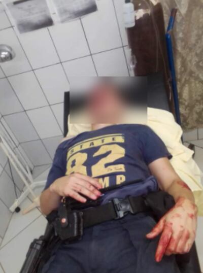 Uno de los policías brutalmente golpeados en la agresión.