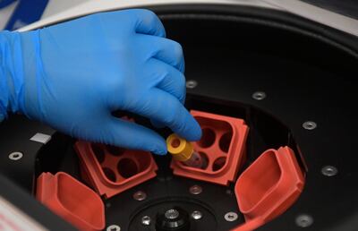 Toma de muestras de personas con sospecha de COVID-19 en el aeropuerto de El Dorado, en Bogotá.