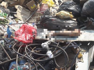 La pierna que sería de una mujer se encontró entre el montículo de basura.