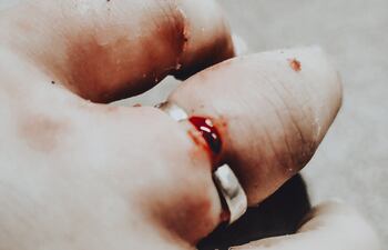 La joven tenía anillos atorados y no había material quirúrgico para retirarlos.