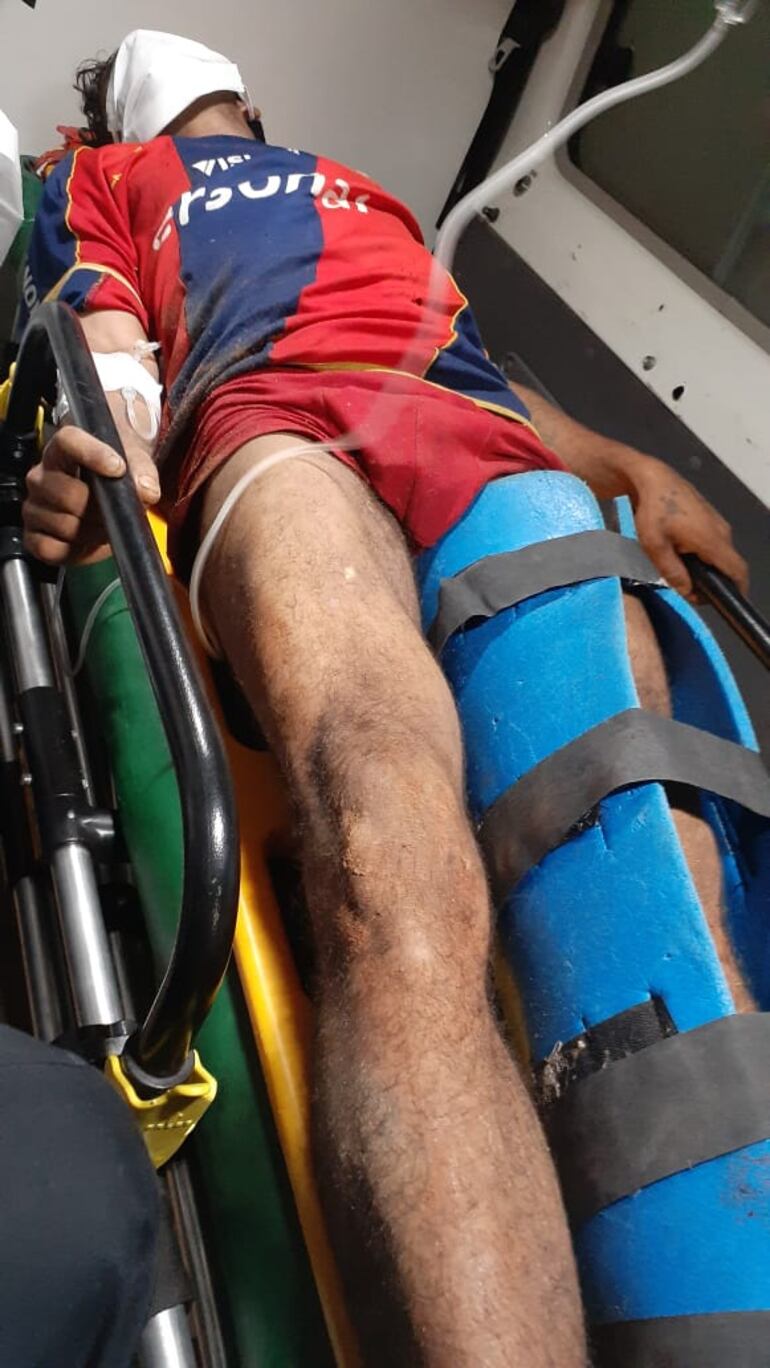 El presunto ladrón herido en el tobillo