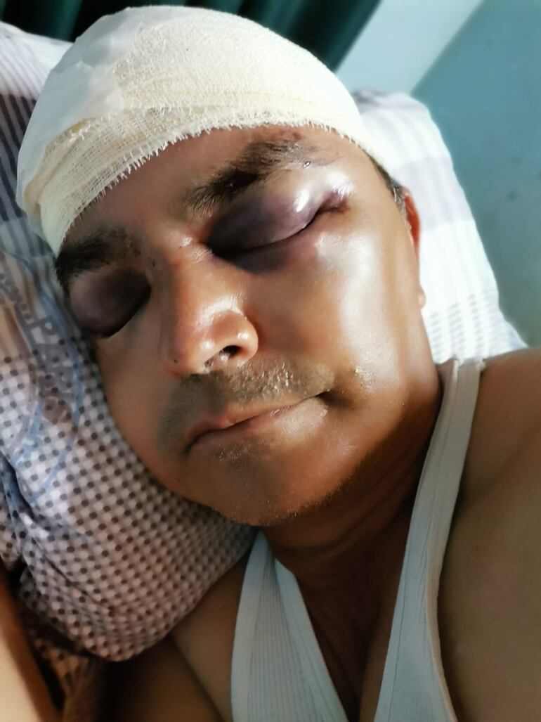 Así quedó el quinielero con 23 puntos de sutura. (gentileza).