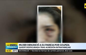 Detuvieron a joven tras brutal golpiza a su pareja