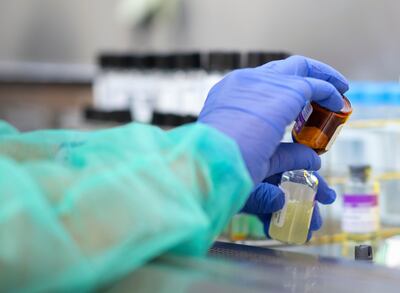 La hidroxicloroquina, un medicamento para el tratamiento de la malaria no protege contra el covid-19, según un estudio publicdo en la revista New England Journal of Medicine.  El uso de esta molécula genera controversia.