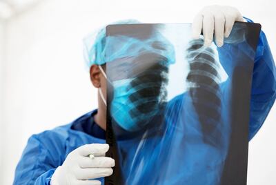 Un especialista observa  la radiografía de una paciente con covid-19. Científicos de todo el mundo trabajan sin pausas para hallar una cura contra la enfermedad aparecido en diciembre en China.