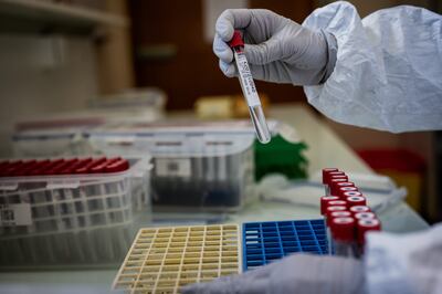 /pf/resources/images/abc-placeholder.png?d=2429