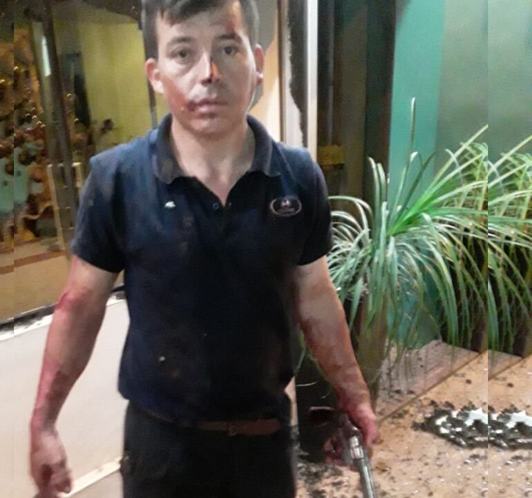 Nelson Vera López, resultó con lesiones cortante en varias partes del cuerpo y fue auxiliado hasta el Hospital Regional de Coronel Oviedo.