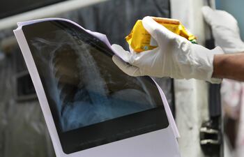 Un enfermero sostiene reportes médicos de un enfermo de coronavirus.