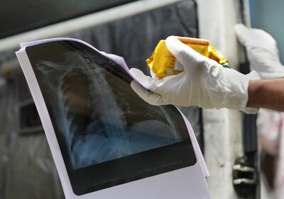 Un enfermero sostiene reportes médicos de un enfermo de coronavirus.