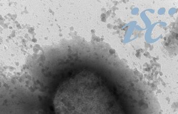 Virus de la viruela del mono por microscopía electrónica, facilitada por el Instituto de Salud Carlos III (ISCIII).