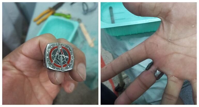 Bomberos de Luque contabilizan al menos tres extracciones de anillos en el mes de enero hasta ahora.