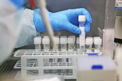 Científicos trabajan en el testeo del covid-19 con muestras tomadas en celulares, hoy en Santiago, Chile.