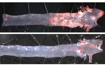 El desarrollo de aterosclerosis exacerbada en la aorta de ratones progeroides (imagen superior) se previene al eliminar progerina en las células de músculo liso vascular (imagen inferior). Imagen facilitada por el Centro Nacional de Investigaciones Cardiovasculares (CNIC).